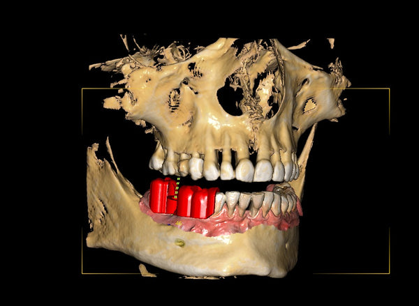 Al comprar un Panorámico 3D, ¿qué debo saber?